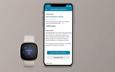 Fitbit Sense най-сетне получава ЕКГ функционалност, но само в някои държави